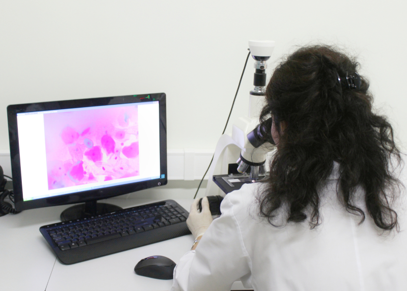 Microscope and computer setup in laboratory for scientific research and microscopic analysis.