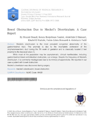Diagnosis, treatment, and surgical outcomes for Meckel's diverticulum.