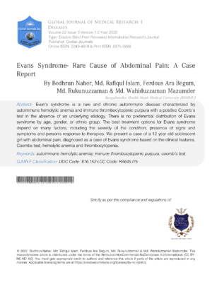 Detailed case report on Evans syndrome highlighting clinical features and treatments.