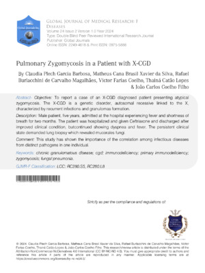 An academic research article on pulmonary zygomycosis in an X-CGD patient highlighting diagnosis, treatment, and clinical outcomes.